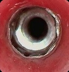 Periosave Classic Ocatagon view 2