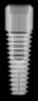 Integrity Implant