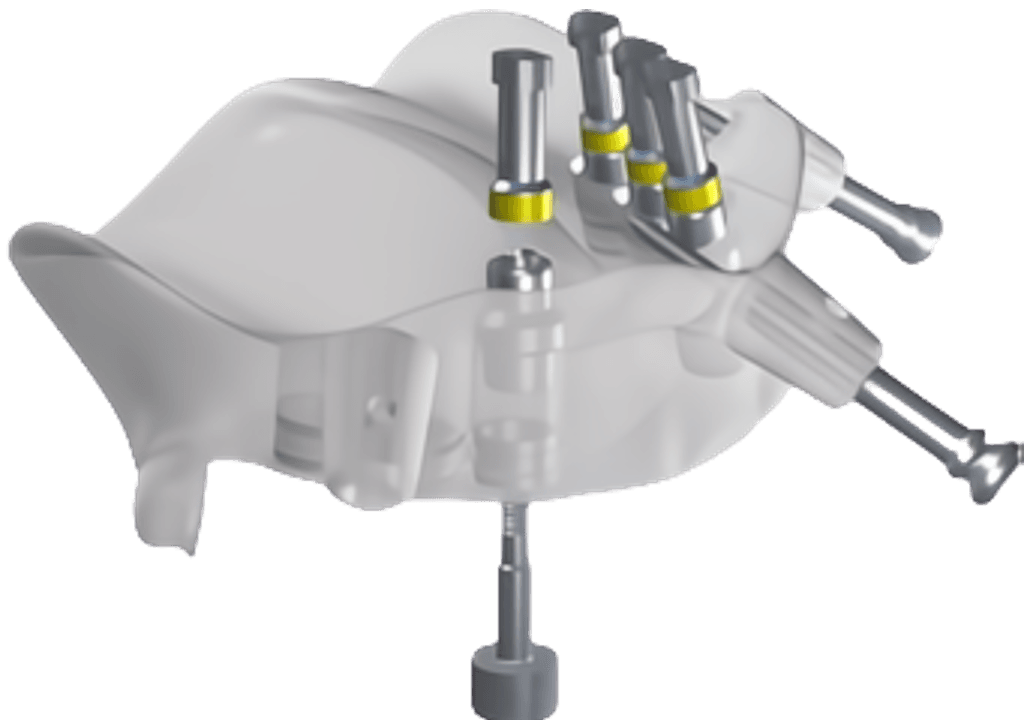 Tissue supported surgical guide