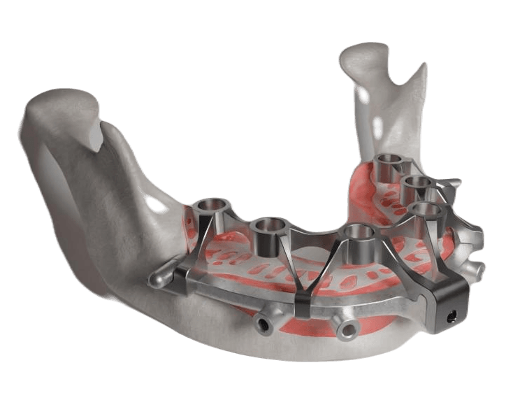 X chrome stackable precision guide for dentist lab drill guide