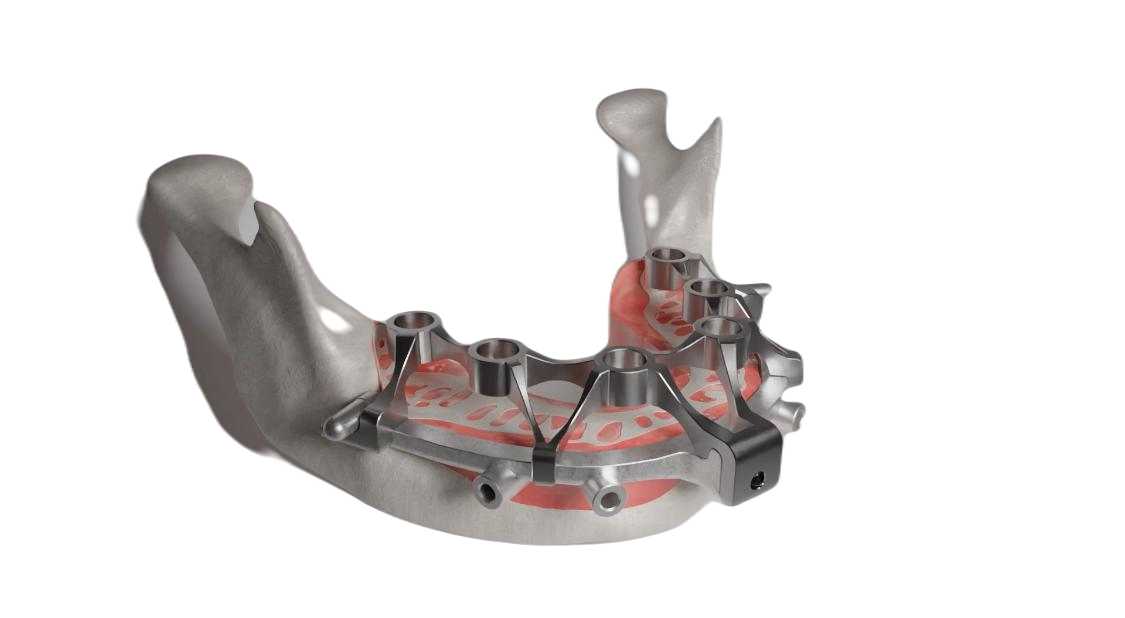 X chrome stackable precision guide for dentist lab drill guide