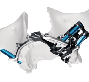 Zygomatic Implants 9 Zygomatic Implants 9
